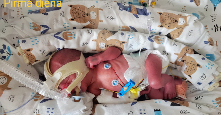 Ankstuko Ąžuolo istorija: mažas kovotojas